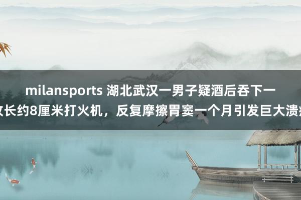milansports 湖北武汉一男子疑酒后吞下一枚长约8厘米打火机，反复摩擦胃窦一个月引发巨大溃疡